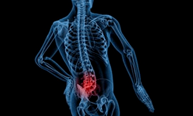 Lumbar osteochondrosisaren garapenaren arrazoiak