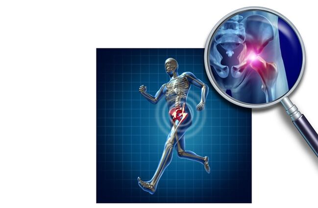 Mina hip junturan korrika egitean